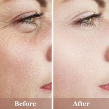 Cargar imagen en el visor de la galería, MIVIDA Trío Suéros Faciales | Vit C 20% + Ác. Hialurónico + Retinol 2.5% | 3x1 fl oz | Ilumina + Reafirma + Hidrata
