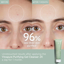 Cargar imagen en el visor de la galería, Caudalie Vinopure Limpiador De Gel Purificador De Poros Con
