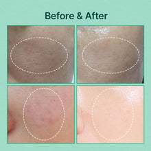 Cargar imagen en el visor de la galería, Natural Derma Project Green Caper Essence 4.4 Fl Oz / 4.39