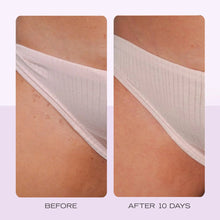 Cargar imagen en el visor de la galería, First Aid Beauty Almohadillas Para El Cabello Encarnado Con