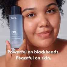 Cargar imagen en el visor de la galería, Hero Cosmetics Solución De Eliminación De Puntos Negros De