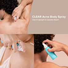Cargar imagen en el visor de la galería, Paulas Choice Clear Spray Exfoliante Para El Acné Para La