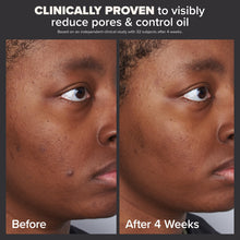 Cargar imagen en el visor de la galería, Paulas Choice Skin Perfecting Exfoliante Líquido De Ácido