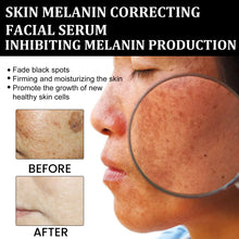 Cargar imagen en el visor de la galería, Suero Facial Corrector De Melanina Corrector De Manchas