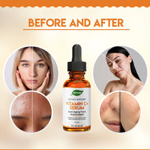 Cargar imagen en el visor de la galería, Yevani Sérum Vitamina C 100% Puro + Ác. Hialurónico + Vitamina E + Aloe Vera + Jojoba | Todos los Tipos de Piel | Área de Ojos
