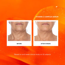 Cargar imagen en el visor de la galería, Sérum Vitamina C 22% + Ciruela Kakadu + Ác. Hialurónico + Vitamina E | Resultados en 4 Semanas | 30ml