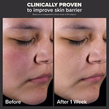 Cargar imagen en el visor de la galería, Paulas Choice Skin Perfecting Exfoliante Líquido De Ácido