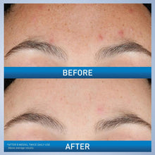 Cargar imagen en el visor de la galería, CeraVe Sérum Retinol Textura y Líneas de Expresión | Antiedad