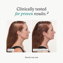 Cargar imagen en el visor de la galería, Nutrafol Balance | Crecimiento Capilar Mujeres +45 | Clínicamente Probado