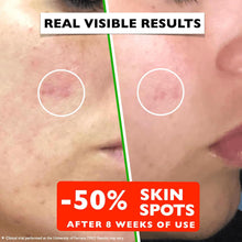 Cargar imagen en el visor de la galería, Suéro Facial Vitamina C 2 fl oz | Niacinamida + Ác. Hialurónico + Antioxidantes | Iluminador + Antimanchas
