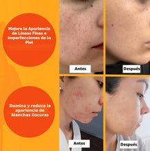 Cargar imagen en el visor de la galería, Suéro Facial Vitamina C 2 fl oz | Niacinamida + Ác. Hialurónico + Antioxidantes | Iluminador + Antimanchas
