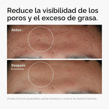 Cargar imagen en el visor de la galería, The Ordinary Niacinamida 10% + Zinc 1% | Sérum Antiimperfecciones | Poros + Brillo + Control Grasa | 30 ml
