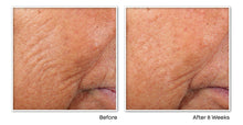 Cargar imagen en el visor de la galería, Roc Retinol Correxion Line Cápsulas De Suero De Noche
