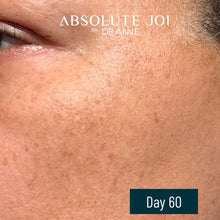 Cargar imagen en el visor de la galería, Aceite de Noche Retinol Granactivo + Vitamina C | Jojoba + Rosa Mosqueta + Moringa | Piel Sensible | 30ml
