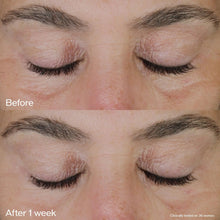Cargar imagen en el visor de la galería, Shiseido Vital Perfection Crema De Ojos Edificante Y
