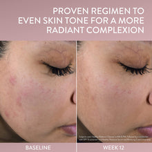 Cargar imagen en el visor de la galería, Cetaphil Limpiador Exfoliante Suave De Healthy Radiance
