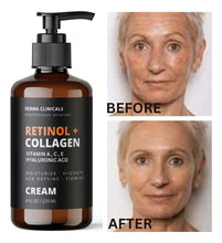 Cargar imagen en el visor de la galería, Crema Facial Retinol + Colágeno + Ác. Hialurónico | Vitamina C y E | Antienvejecimiento | Día y Noche | 4 oz
