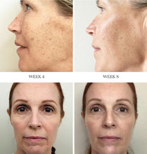 Cargar imagen en el visor de la galería, City Beauty Sistema Avanzado De Retinol 2 Sueros Faciales
