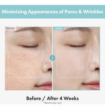 Cargar imagen en el visor de la galería, Tosowoong Crema Refinadora De Poros Crema Facial Extractor
