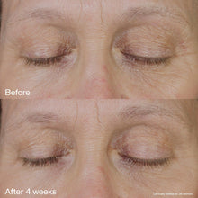 Cargar imagen en el visor de la galería, Shiseido Vital Perfection Crema De Ojos Edificante Y
