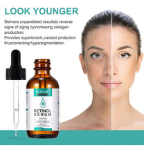 Cargar imagen en el visor de la galería, Suero De Retinol Sistema De Suministro De Liposomas De
