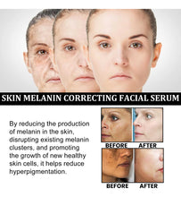 Cargar imagen en el visor de la galería, Suero Facial Corrector De Melanina Corrector De Manchas
