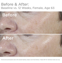 Cargar imagen en el visor de la galería, Skinmedica Total Defense + Repair Protector Solar Teñido Spf
